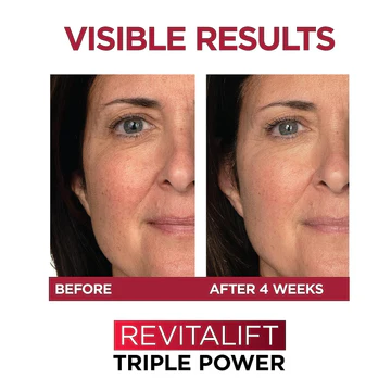 L´oreal Revitalift Triple Power Serum 30ml